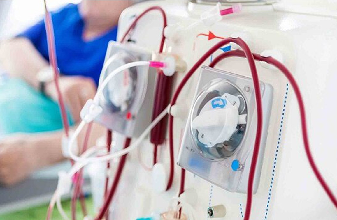 پایان صف‌های انتظار دیالیز در هرمزگان با تفاهم‌نامه سلامت